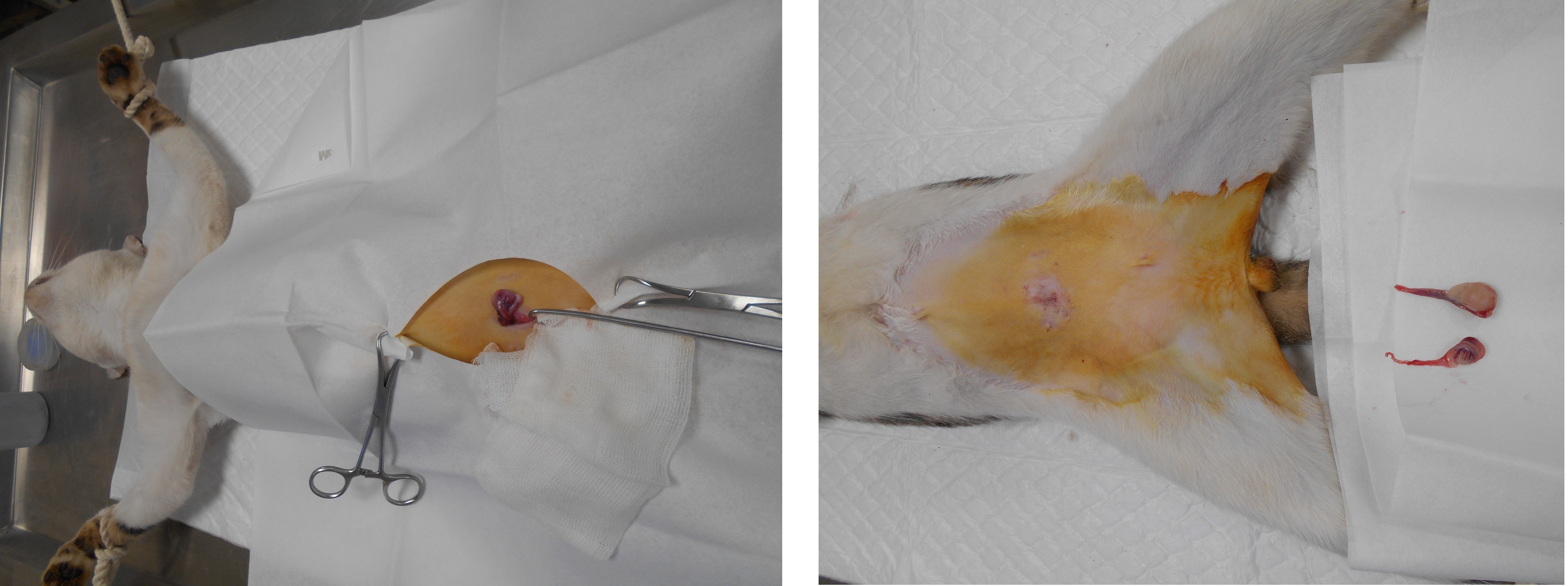 手術於腹腔內取出右側腹腔隱睪，右側睪丸明顯異於正常睪丸